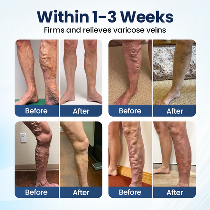 Owiwell® Deep Vein Repair Microneedle Patch