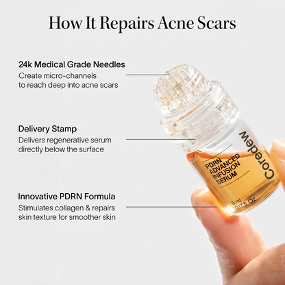 PDRN Advanced Infusion Treatment