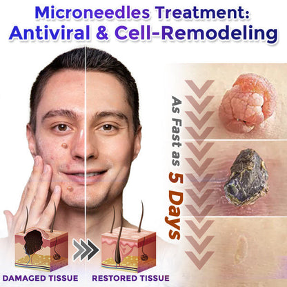 👩‍⚕️☘️Celsiora® Multi-Functional Microneedle Hydrocolloid Patch Roll | Targets Skin Tags, Warts & Stubborn Blemishes
