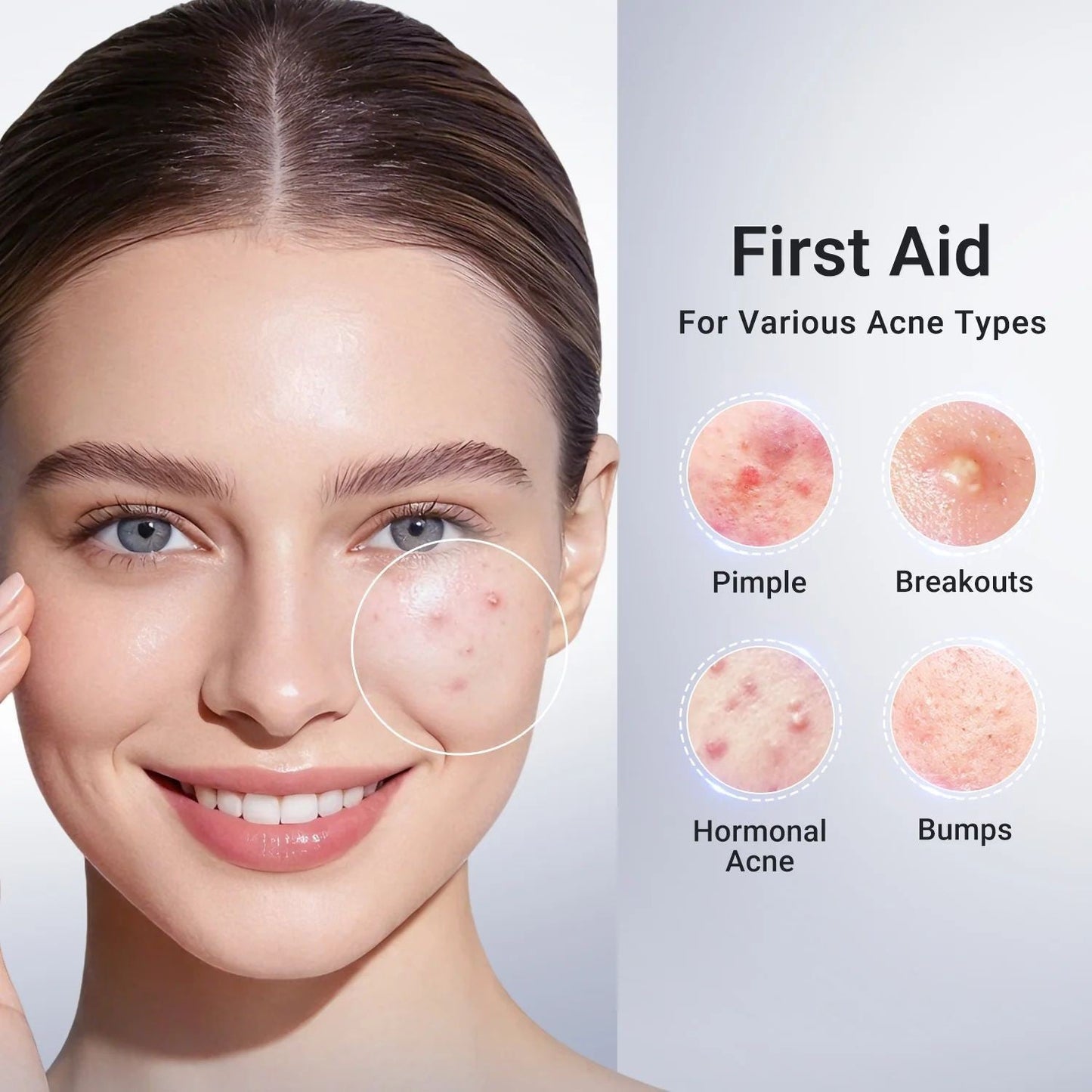 Acne-Fighting Serum with Salicylic Acid