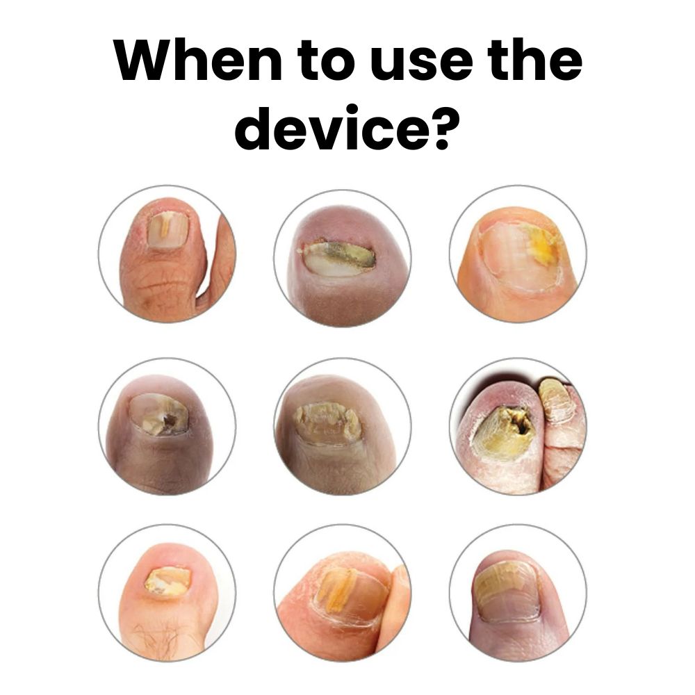 Owiwell Device