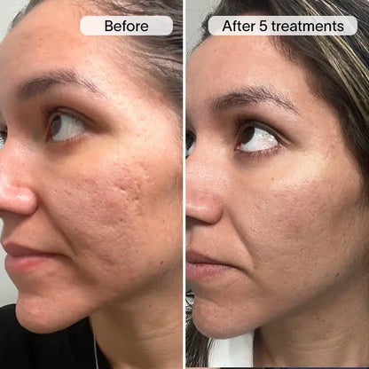 PDRN Advanced Infusion Treatment