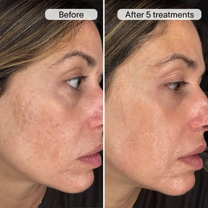 PDRN Advanced Infusion Treatment